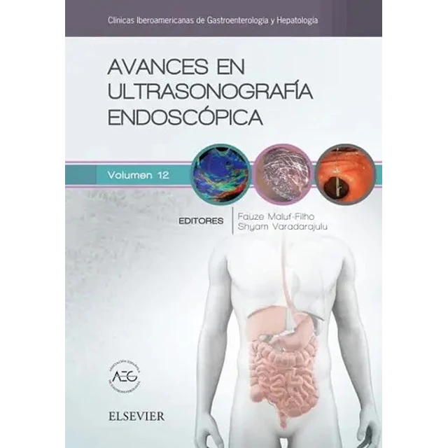Avances en Ultrasonografía Endoscópica