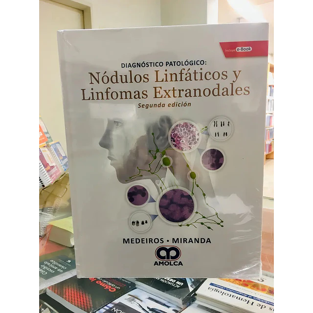 Nódulos Linfáticos y Linfomas Extranodales : Diagnóstico Patológico