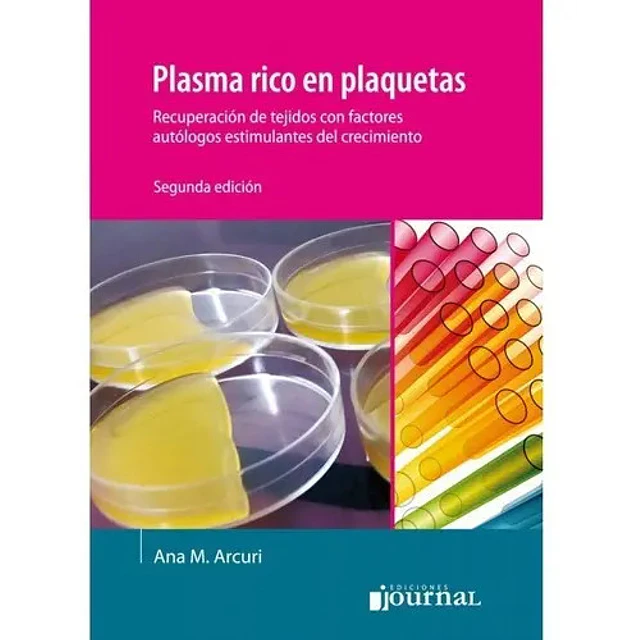 Plasma rico en plaquetas