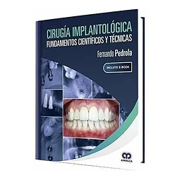 Cirugía Implantológica