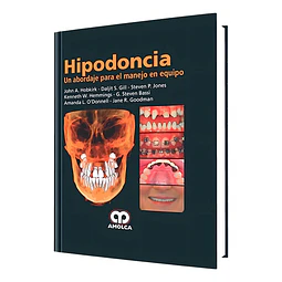 Hipodoncia