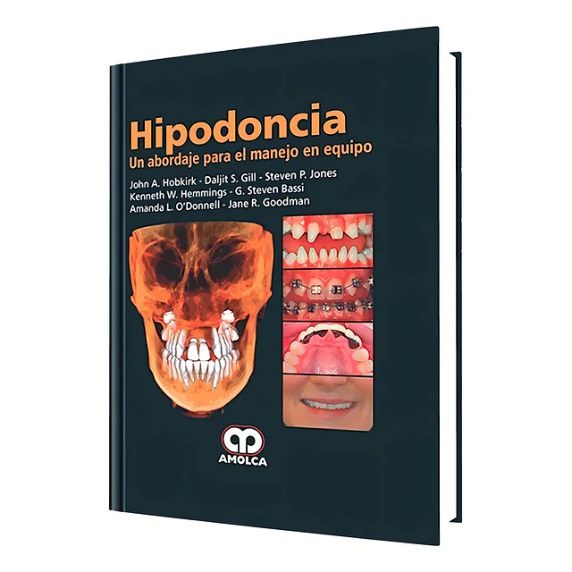 Hipodoncia
