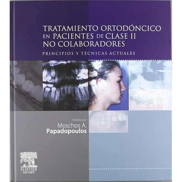 Tratamiento Ortodoncico en Pacientes de Clase II No Colaboradores