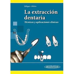 La Extracción Dentaria