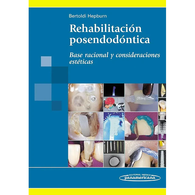 Rehabilitación posendodóntica