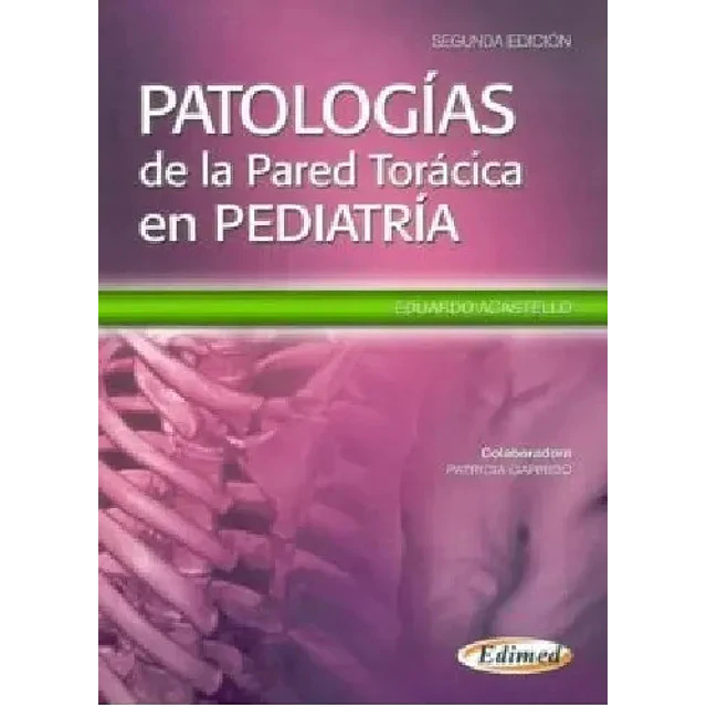 Patologías de la Pared Torácica en Pediatría