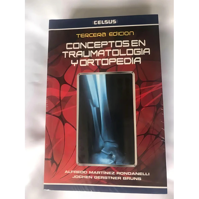 Conceptos en Traumatología y Ortopedia