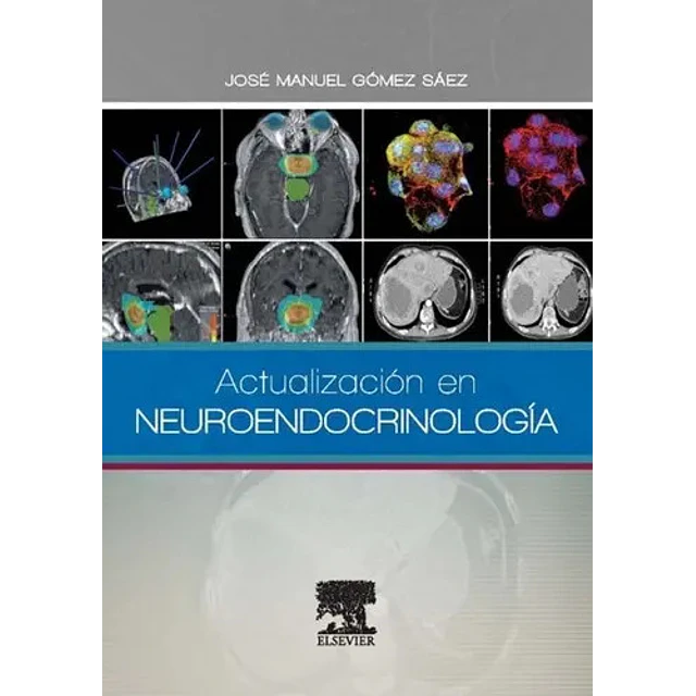 Actualización en Neuroendocrinología