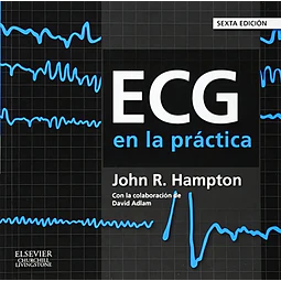 ECG en la práctica