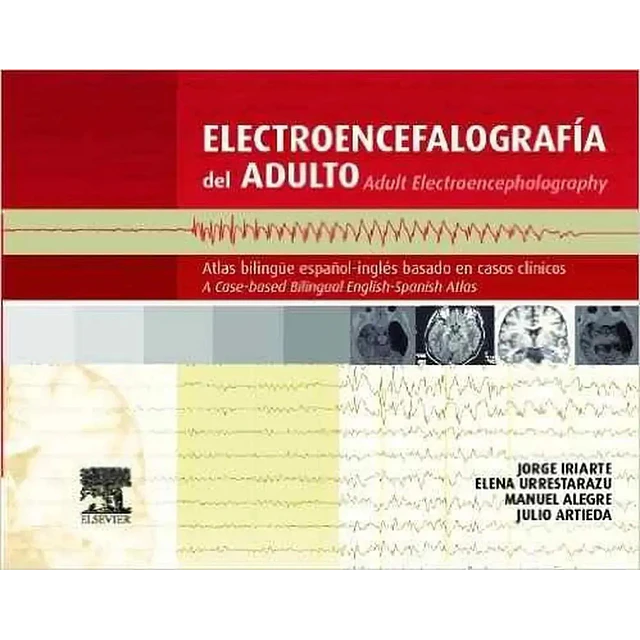 Electroencefalografía del Adulto