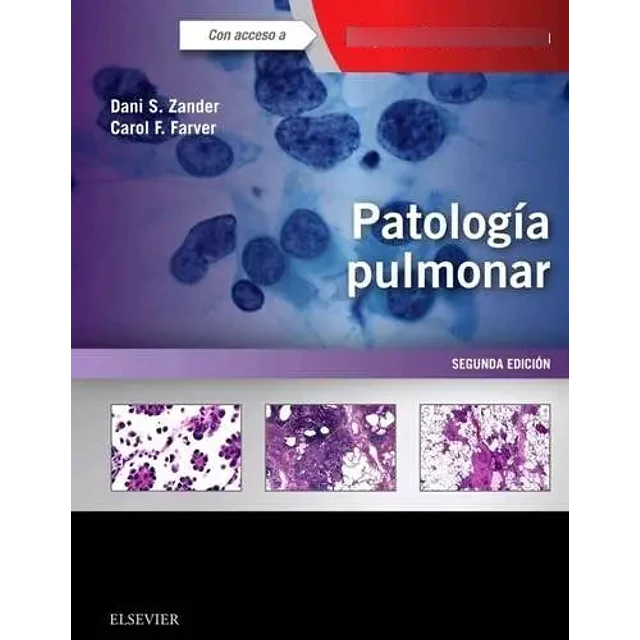 Patología Pulmonar