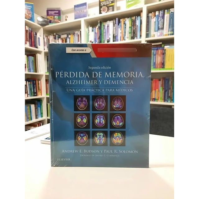 Pérdida de Memoria, Alzheimer y Demencia