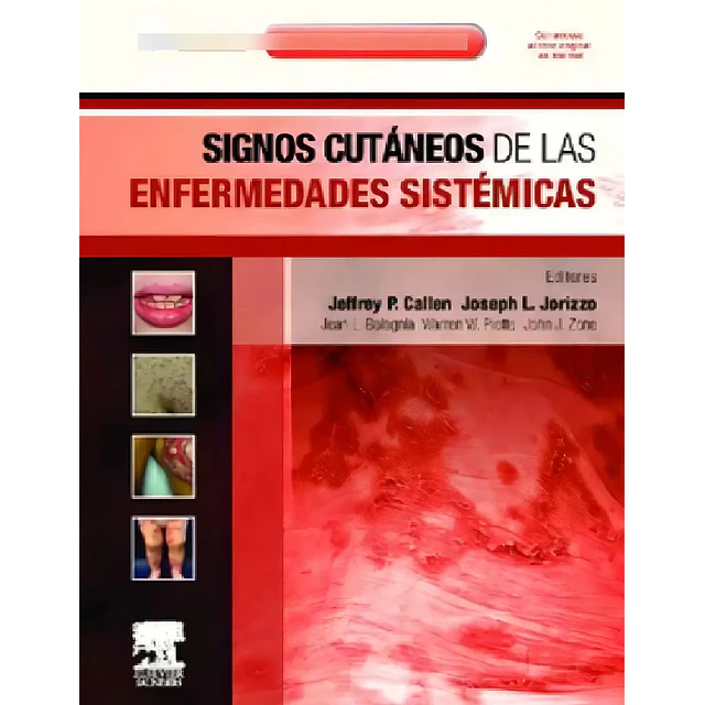 Signos cutáneos de las enfermedades sistémicas