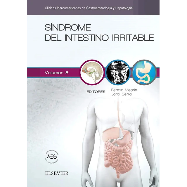 Síndrome del Intestino Irritable