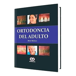 Ortodoncia del Adulto