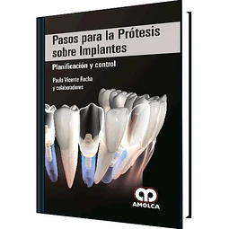 Pasos para la Prótesis sobre Implantes