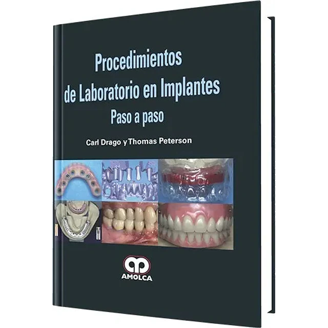 Procedimientos de Laboratorio en Implantes