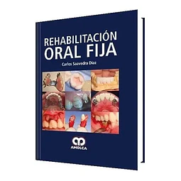 Rehabilitación Oral Fija