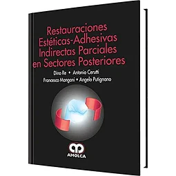 Restauraciones Esteticas-Adhesivas Indirectas Parciales en Sectores Posteriores