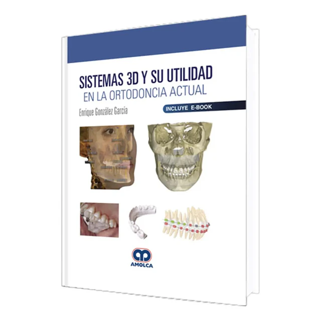 Sistemas 3D y su Utilidad en la Ortodoncia Actual