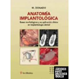 Anatomía Implantológica