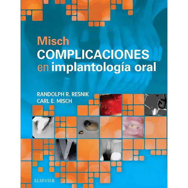 Complicaciones en Implantología Oral Misch
