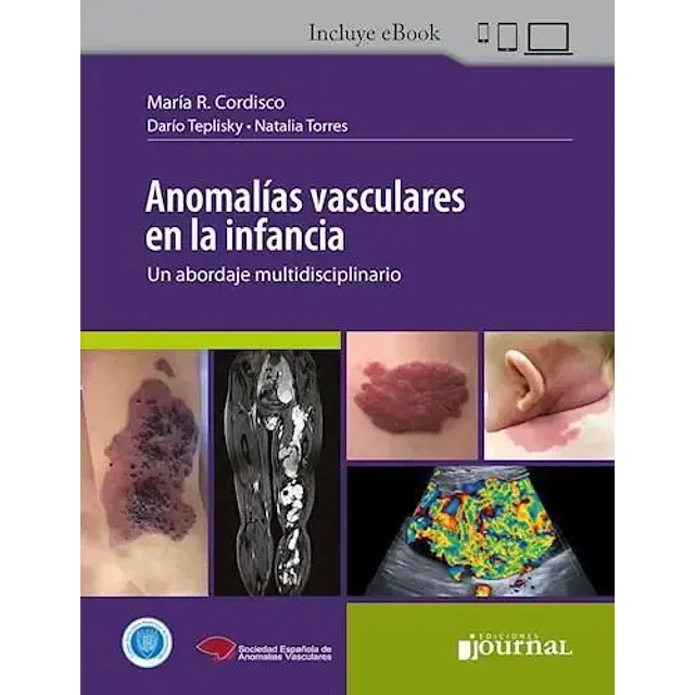 Anomalías vasculares en la infancia. Un abordaje multidisciplinario