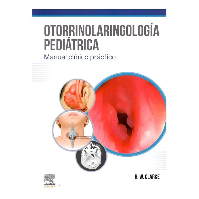 Otorrinolaringología Pediátrica