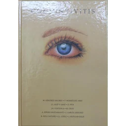 Conjuntivitis