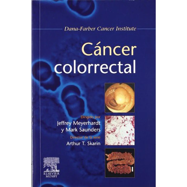 Cancer Colorrectal