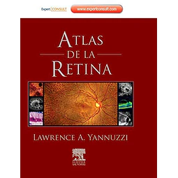 Atlas de la Retina