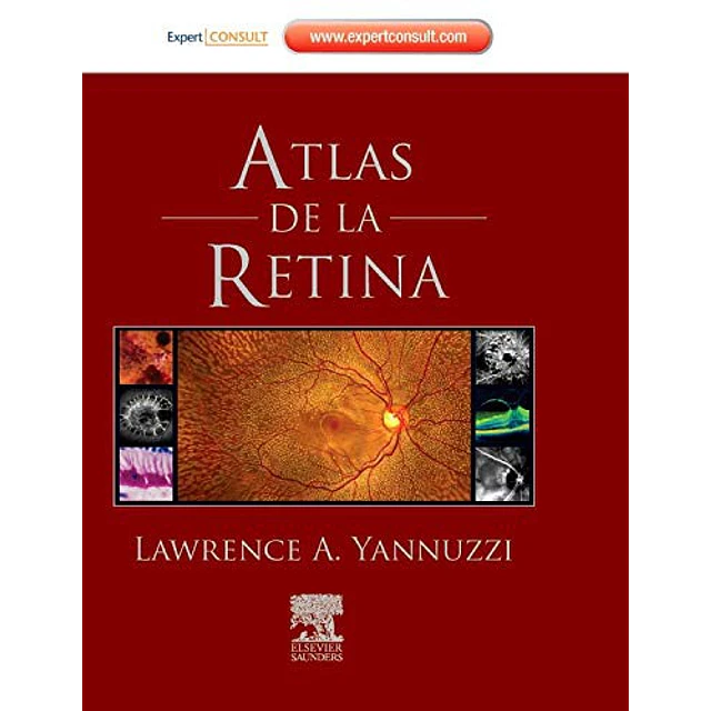 Atlas de la Retina