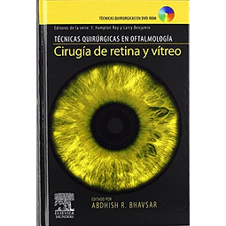 Cirugia de retina y vitreo