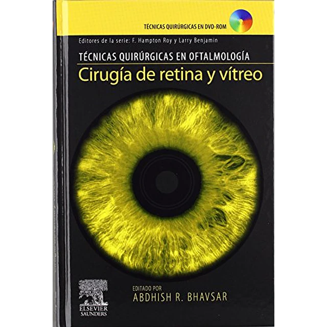 Cirugia de retina y vitreo