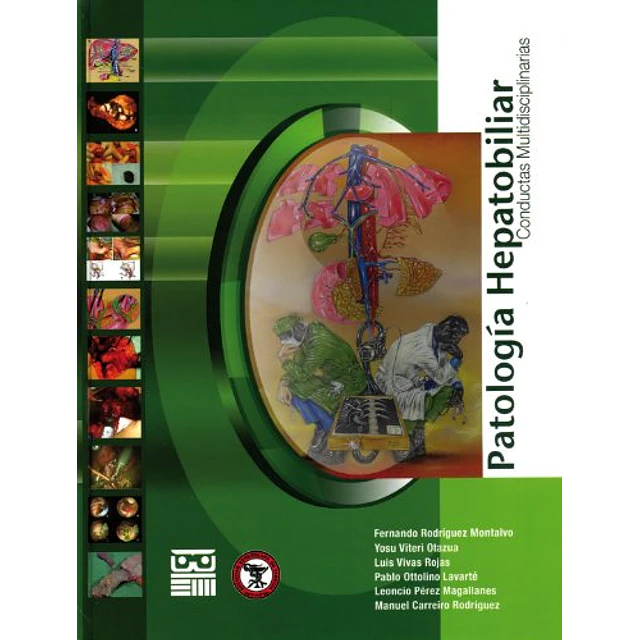 Patología Hepatobiliar