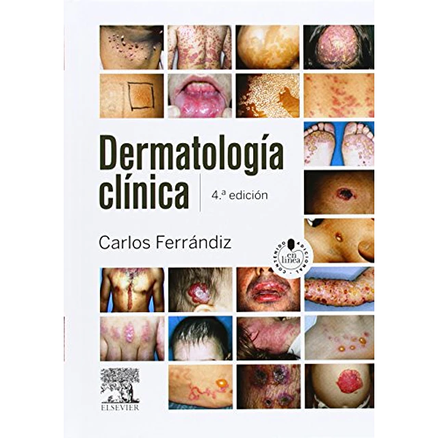 Dermatología clínica