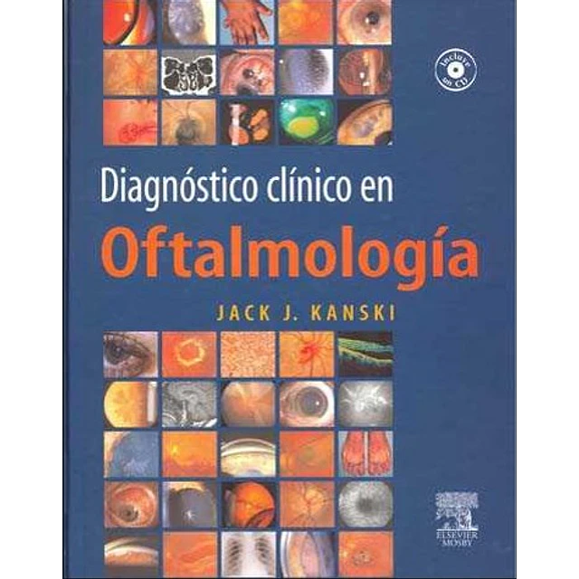 Diagnostico clinico en Oftalmologia