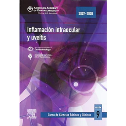 Inflamación intraocular y uveítis