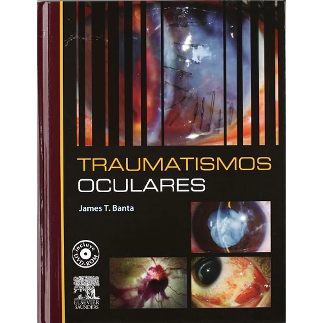 Traumatismos Oculares