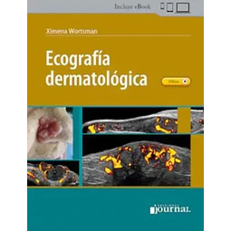 Ecografía dermatológica