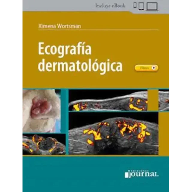 Ecografía dermatológica