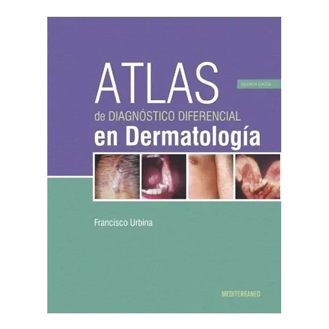 Atlas de Diagnóstico Diferencial en Dermatología