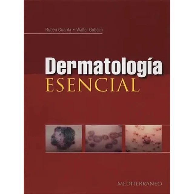 Dermatología esencial