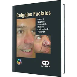 Colgajos Faciales
