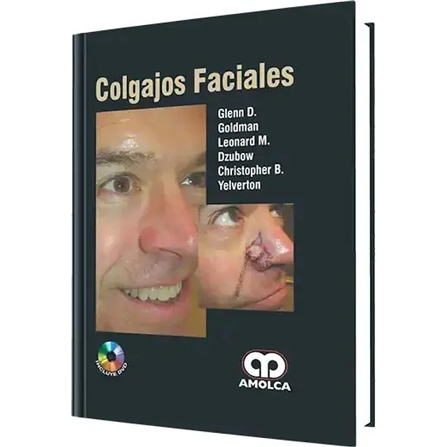 Colgajos Faciales