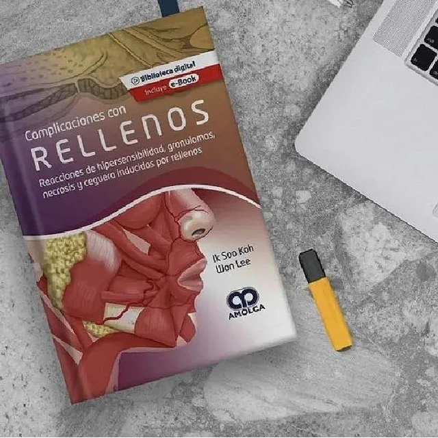 Complicaciones con rellenos