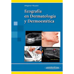 Ecografía en Dermatología y Dermoestética