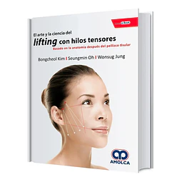 El arte y la ciencia del lifting con hilos tensores