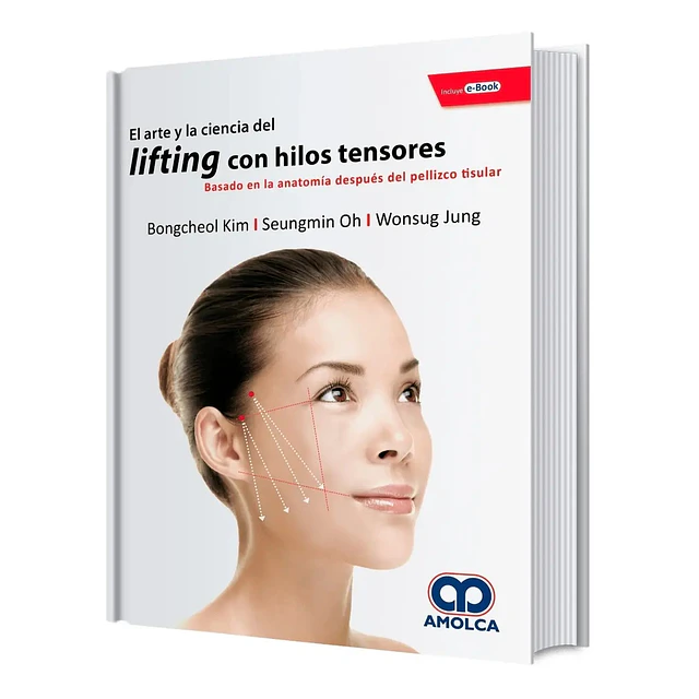 El arte y la ciencia del lifting con hilos tensores