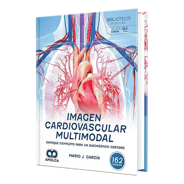 Imagen cardiovascular multimodal. Enfoque completo para un diagnóstico certero